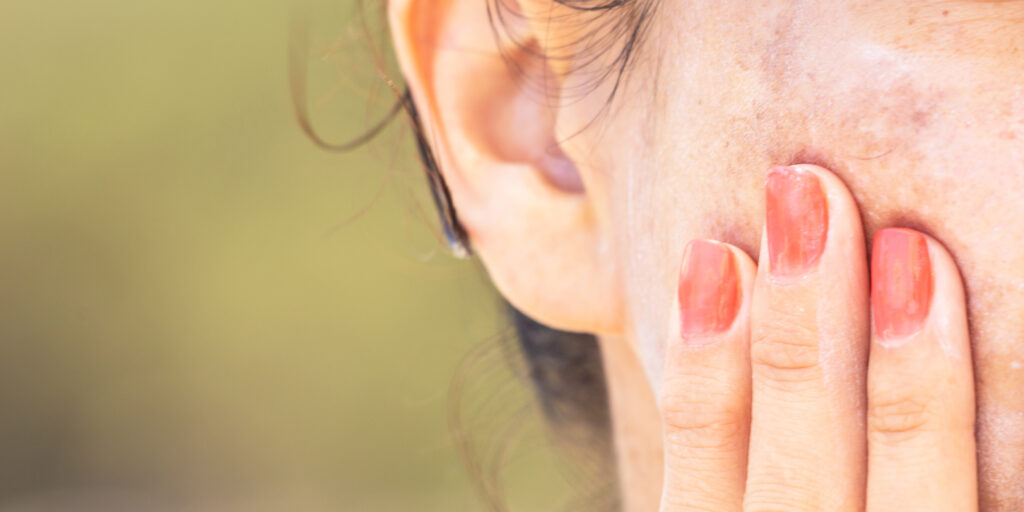 Closeup of woman’s hand on cheek that has age spots